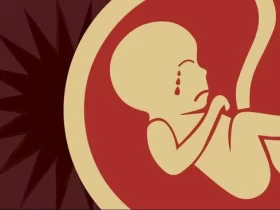 aborsi